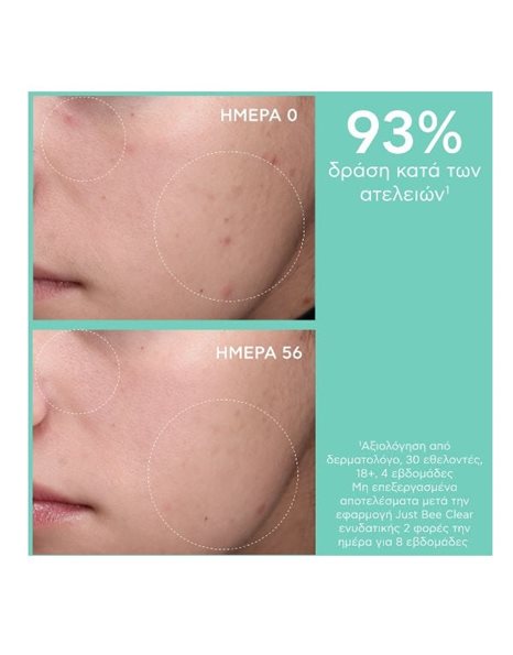 Apivita Just Bee Clear Κρέμα Κατά Των Ατελειών Με Πρόπολη AmC & Φυτικό Σαλικυλικό Οξύ 40ml.