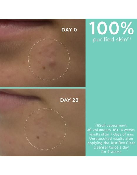 Apivita Just Bee Clear Gel Καθαρισμού Με Πρόπολη AmC & Φυτικό Σαλικυλικό Οξύ 200ml.