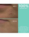 Apivita Just Bee Clear Gel Καθαρισμού Με Πρόπολη AmC & Φυτικό Σαλικυλικό Οξύ 200ml.