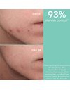 Apivita Just Bee Clear Gel Καθαρισμού Με Πρόπολη AmC & Φυτικό Σαλικυλικό Οξύ 200ml.