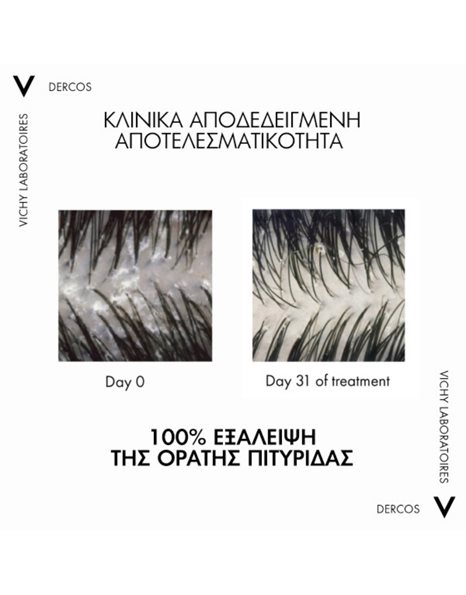 Vichy Dercos Anti Dandruff DS Σαμπουάν κατά της Πιτυρίδας για Ξηρά Μαλλιά 200ml