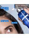 Uriage D.S. Hair Regulating Anti-Dandruff Lotion - Αντιπυτιριδική Λοσιόν για Εξισορρόπηση 100ml